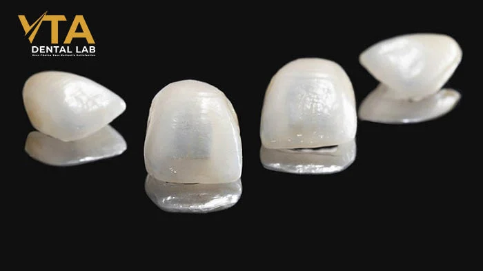 Emax vs Zirconia Veneers: What’s the Difference?